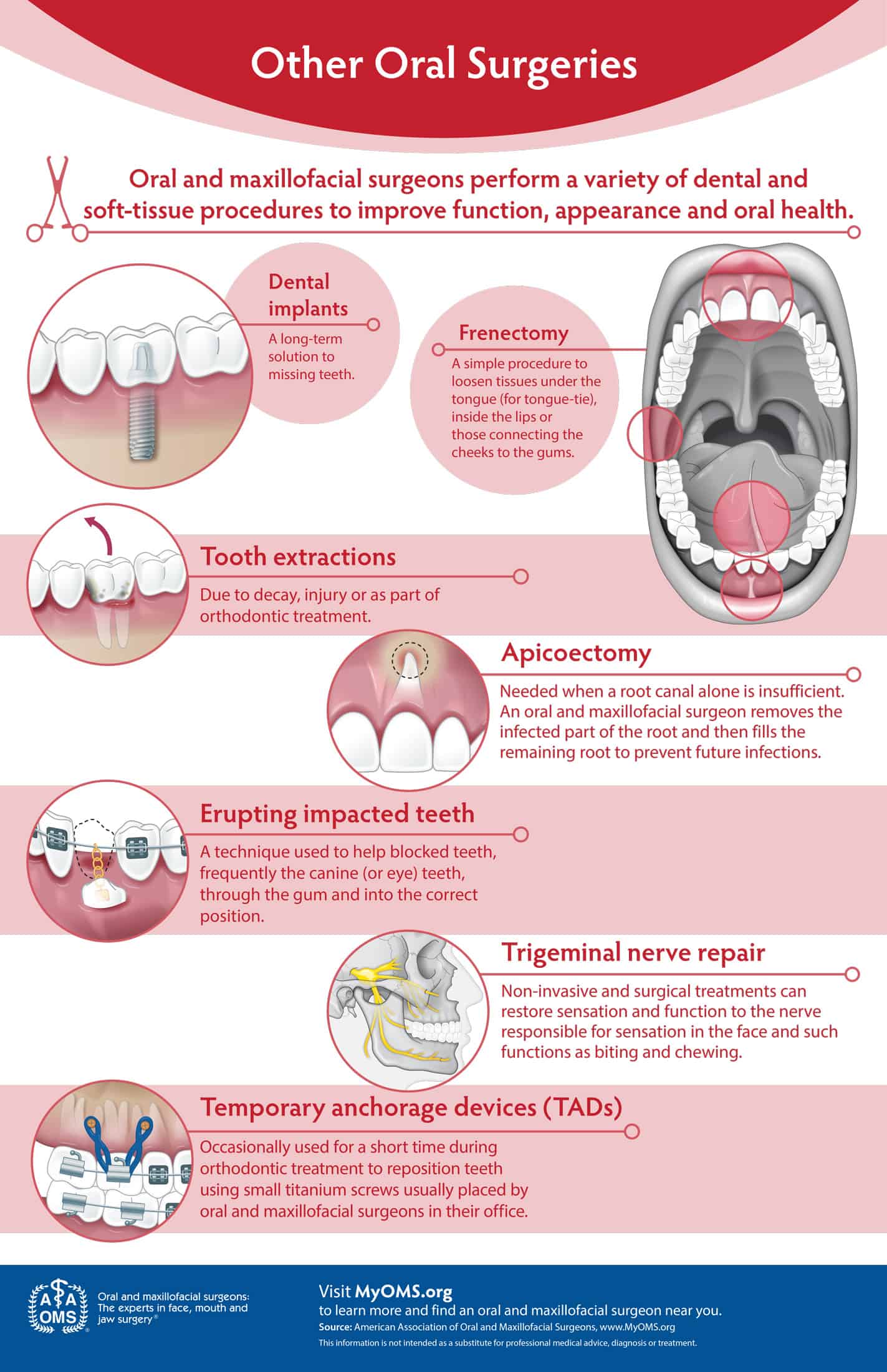 other_surgeries_infographic