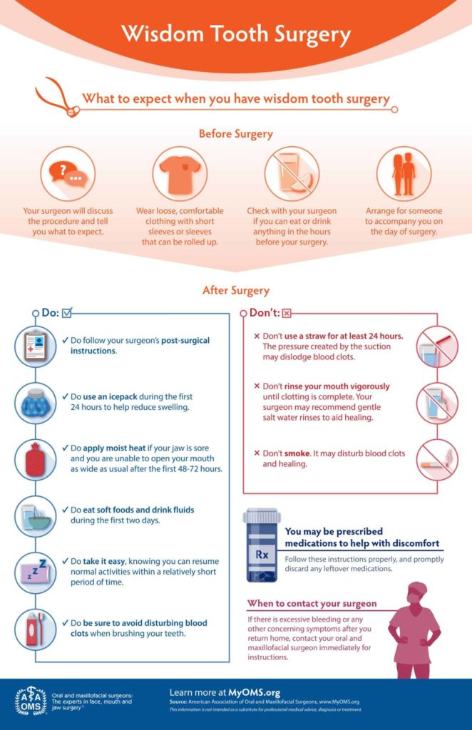 wisdom teeth surgery infographic